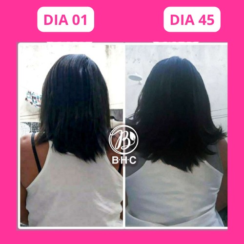Depoimento 3